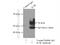 Interleukin 7 Receptor antibody, 17626-1-AP, Proteintech Group, Immunoprecipitation image 