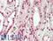 SWI/SNF Related, Matrix Associated, Actin Dependent Regulator Of Chromatin, Subfamily A, Member 4 antibody, LS-B11769, Lifespan Biosciences, Immunohistochemistry frozen image 