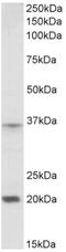 Homeobox A9 antibody, AP32715PU-N, Origene, Western Blot image 