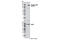 EPH Receptor A2 antibody, 8244S, Cell Signaling Technology, Western Blot image 