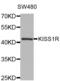 KISS1 Receptor antibody, abx002159, Abbexa, Western Blot image 