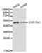 Cyp17 antibody, abx001208, Abbexa, Western Blot image 