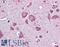 Eukaryotic Translation Initiation Factor 2B Subunit Beta antibody, LS-B6193, Lifespan Biosciences, Immunohistochemistry frozen image 