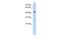 Acyl-CoA Binding Domain Containing 5 antibody, GTX46592, GeneTex, Western Blot image 