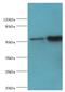 Dipeptidyl Peptidase 7 antibody, MBS1495802, MyBioSource, Western Blot image 