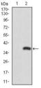 RUNX Family Transcription Factor 3 antibody, GTX60639, GeneTex, Western Blot image 