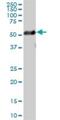 Tubulin beta-1 chain antibody, H00081027-B01P, Novus Biologicals, Western Blot image 