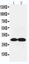 Collagen Type IV Alpha 1 Chain antibody, PA5-79058, Invitrogen Antibodies, Western Blot image 