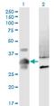 Metallophosphoesterase Domain Containing 2 antibody, MA5-24542, Invitrogen Antibodies, Western Blot image 