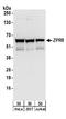 Zinc Finger Protein 622 antibody, A304-076A, Bethyl Labs, Western Blot image 
