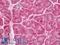 ABI Family Member 3 Binding Protein antibody, LS-B12362, Lifespan Biosciences, Immunohistochemistry paraffin image 