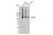 Solute Carrier Family 17 Member 6 antibody, 14487S, Cell Signaling Technology, Western Blot image 