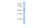 Branched Chain Keto Acid Dehydrogenase E1 Subunit Alpha antibody, GTX45109, GeneTex, Western Blot image 