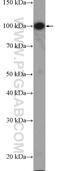 MAGE Family Member D1 antibody, 22053-1-AP, Proteintech Group, Western Blot image 