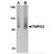 Transportin 3 antibody, TA306573, Origene, Western Blot image 