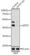 SET Domain Containing 7, Histone Lysine Methyltransferase antibody, GTX64659, GeneTex, Western Blot image 