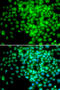 RNA Polymerase II Subunit F antibody, STJ25049, St John