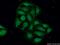 Myosin-X antibody, 24565-1-AP, Proteintech Group, Immunofluorescence image 