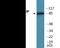 ATR Interacting Protein antibody, EKC2189, Boster Biological Technology, Western Blot image 