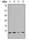 Histone Cluster 1 H2B Family Member A antibody, orb382593, Biorbyt, Western Blot image 