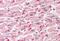 Junction Plakoglobin antibody, GTX11799, GeneTex, Immunohistochemistry paraffin image 