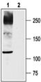 Sodium Voltage-Gated Channel Alpha Subunit 10 antibody, PA5-77732, Invitrogen Antibodies, Western Blot image 