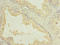 Solute Carrier Family 7 Member 14 antibody, LS-C378687, Lifespan Biosciences, Immunohistochemistry paraffin image 