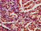 Chromatin Assembly Factor 1 Subunit A antibody, LS-C680274, Lifespan Biosciences, Immunohistochemistry paraffin image 