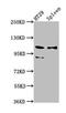 Signal peptide, CUB and EGF-like domain-containing protein 2 antibody, CSB-PA865101LA01HU, Cusabio, Western Blot image 