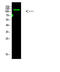 Collagen Type I Alpha 2 Chain antibody, STJ98862, St John