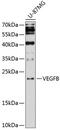 Vascular Endothelial Growth Factor B antibody, 14-581, ProSci, Western Blot image 