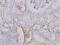 Solute Carrier Family 25 Member 11 antibody, H00008402-M01, Novus Biologicals, Immunohistochemistry frozen image 