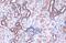 Acyl-CoA Synthetase Long Chain Family Member 4 antibody, GTX100260, GeneTex, Immunohistochemistry paraffin image 