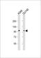 Semaphorin-4B antibody, M08999, Boster Biological Technology, Western Blot image 