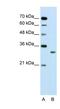 SBDS Ribosome Maturation Factor antibody, NBP1-55131, Novus Biologicals, Western Blot image 