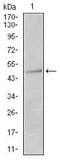 Keratin 13 antibody, MA5-17109, Invitrogen Antibodies, Western Blot image 