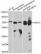 USH1 Protein Network Component Harmonin antibody, A4368, ABclonal Technology, Western Blot image 