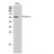 Dyskerin Pseudouridine Synthase 1 antibody, LS-C383232, Lifespan Biosciences, Western Blot image 