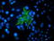 Vasodilator Stimulated Phosphoprotein antibody, LS-C172706, Lifespan Biosciences, Immunofluorescence image 