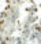 Enhancer Of Zeste 1 Polycomb Repressive Complex 2 Subunit antibody, 6261, ProSci, Immunohistochemistry frozen image 