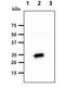 Killer Cell Immunoglobulin Like Receptor, Two Ig Domains And Long Cytoplasmic Tail 3 antibody, NBP1-04316, Novus Biologicals, Western Blot image 