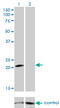 Guanylate Cyclase Activator 1A antibody, LS-C197382, Lifespan Biosciences, Western Blot image 