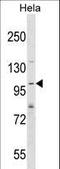 SH3 And PX Domains 2A antibody, LS-C169066, Lifespan Biosciences, Western Blot image 