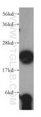 Ribosomal Protein L18a antibody, 15751-1-AP, Proteintech Group, Western Blot image 