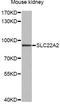 S22A2 antibody, LS-C749074, Lifespan Biosciences, Western Blot image 