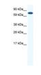 CBFA2/RUNX1 Partner Transcriptional Co-Repressor 2 antibody, NBP1-91617, Novus Biologicals, Western Blot image 