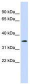 G Protein-Coupled Receptor 6 antibody, TA346402, Origene, Western Blot image 