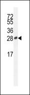 Inducible T Cell Costimulator antibody, LS-C100393, Lifespan Biosciences, Western Blot image 