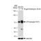 Activating Transcription Factor 2 antibody, GTX03187, GeneTex, Western Blot image 