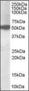 AKT Serine/Threonine Kinase 3 antibody, orb89293, Biorbyt, Western Blot image 